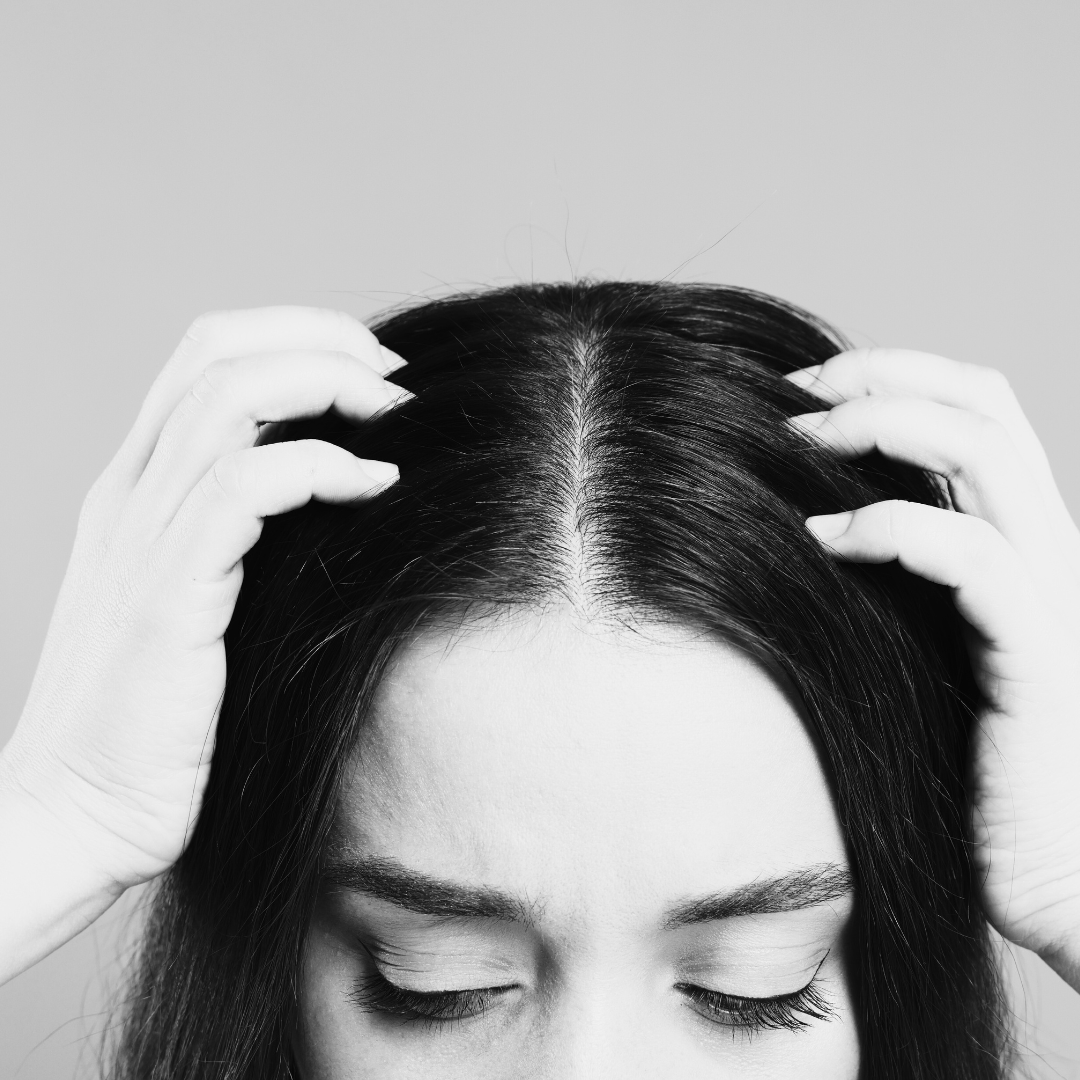 5 Signs of an Unhealthy Scalp and How to Fix It